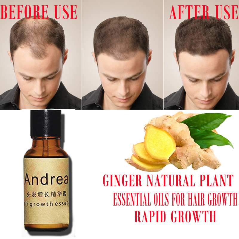 2/5/10Pcs Andrea Hair Growth S - Hair Care Herbal recension och pris