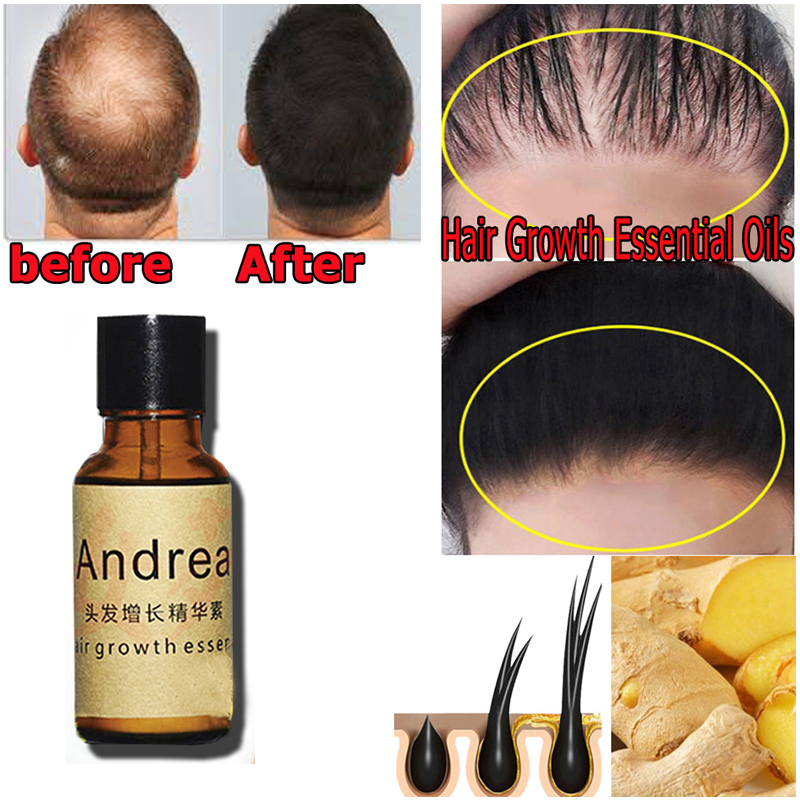 2/5/10Pcs Andrea Hair Growth S - Hair Care Herbal recension och pris